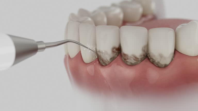 Trusted Root Canal Treatment service in Bonham, TX - Dentist Open Now